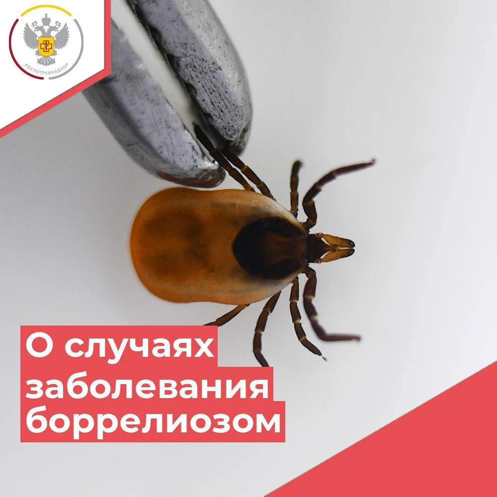 О случаях заболевания клещевым боррелиозом.  