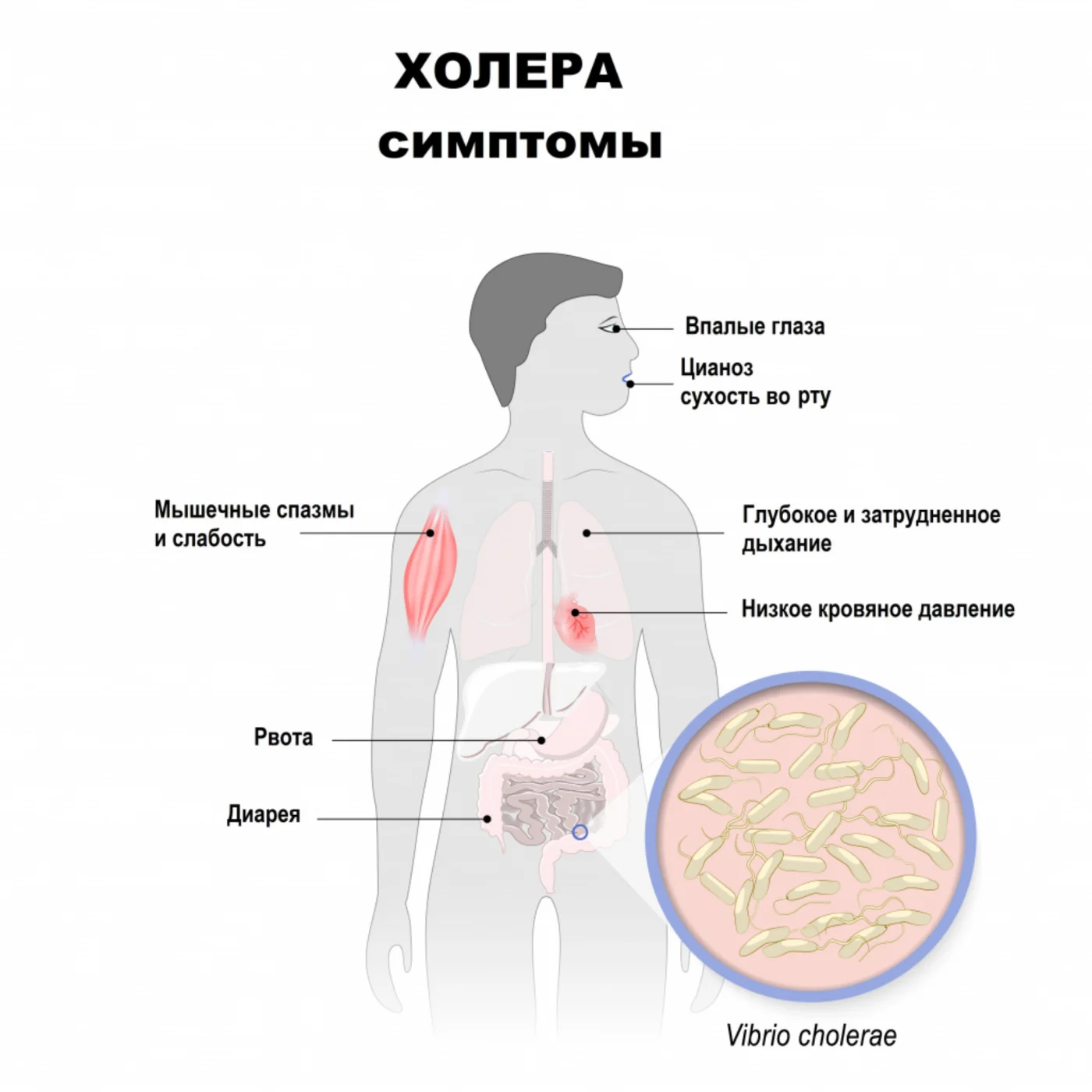 Профилактика холеры